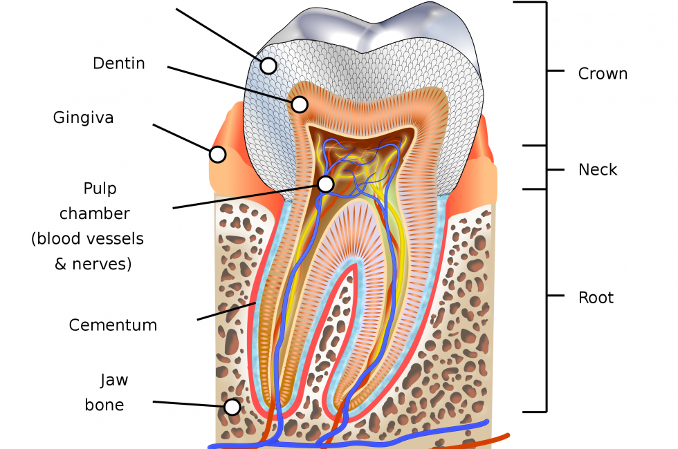 toothache