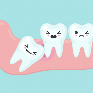 is wisdom tooth surgery painful