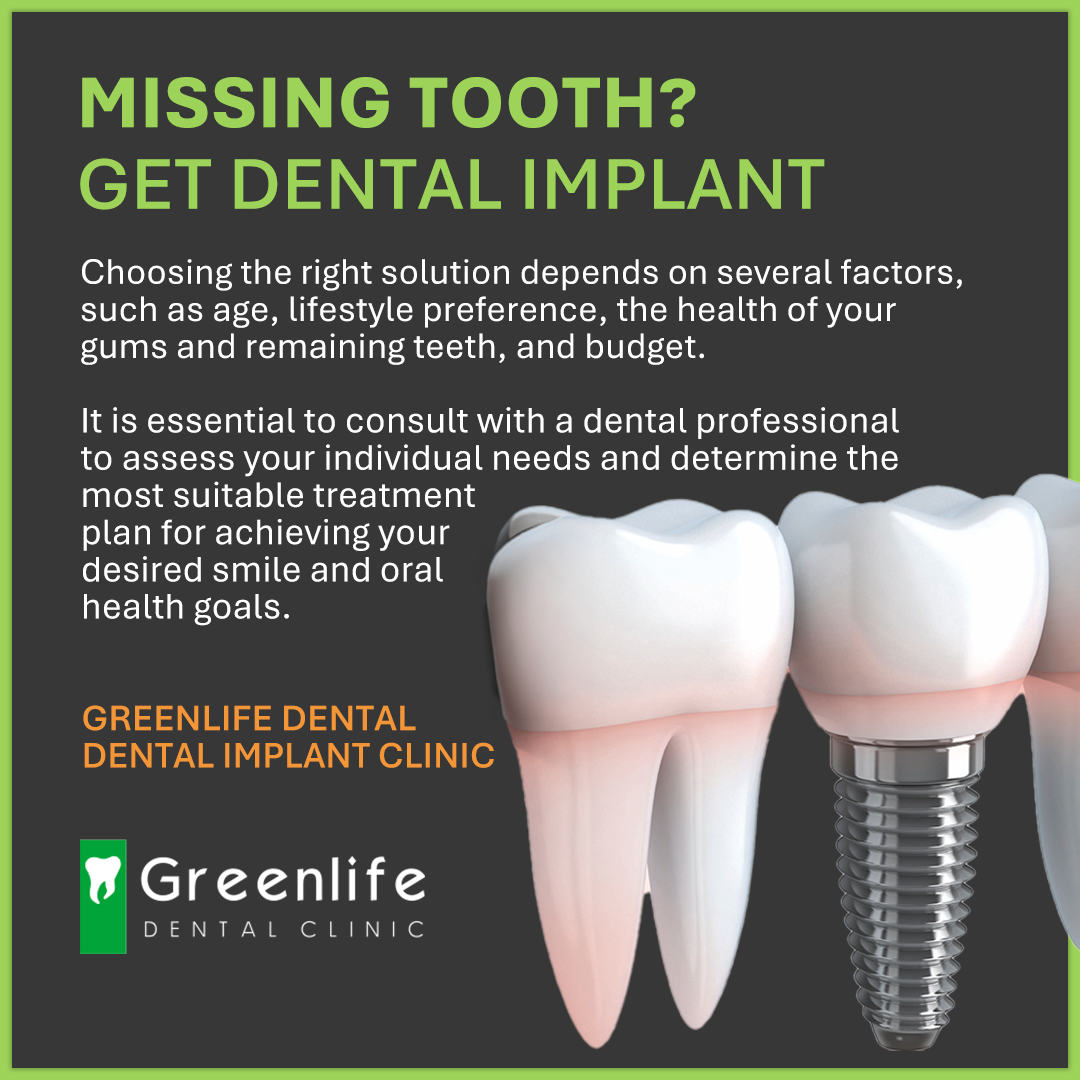 Restore Your Smile : Replace Missing Teeth with Dental Implant