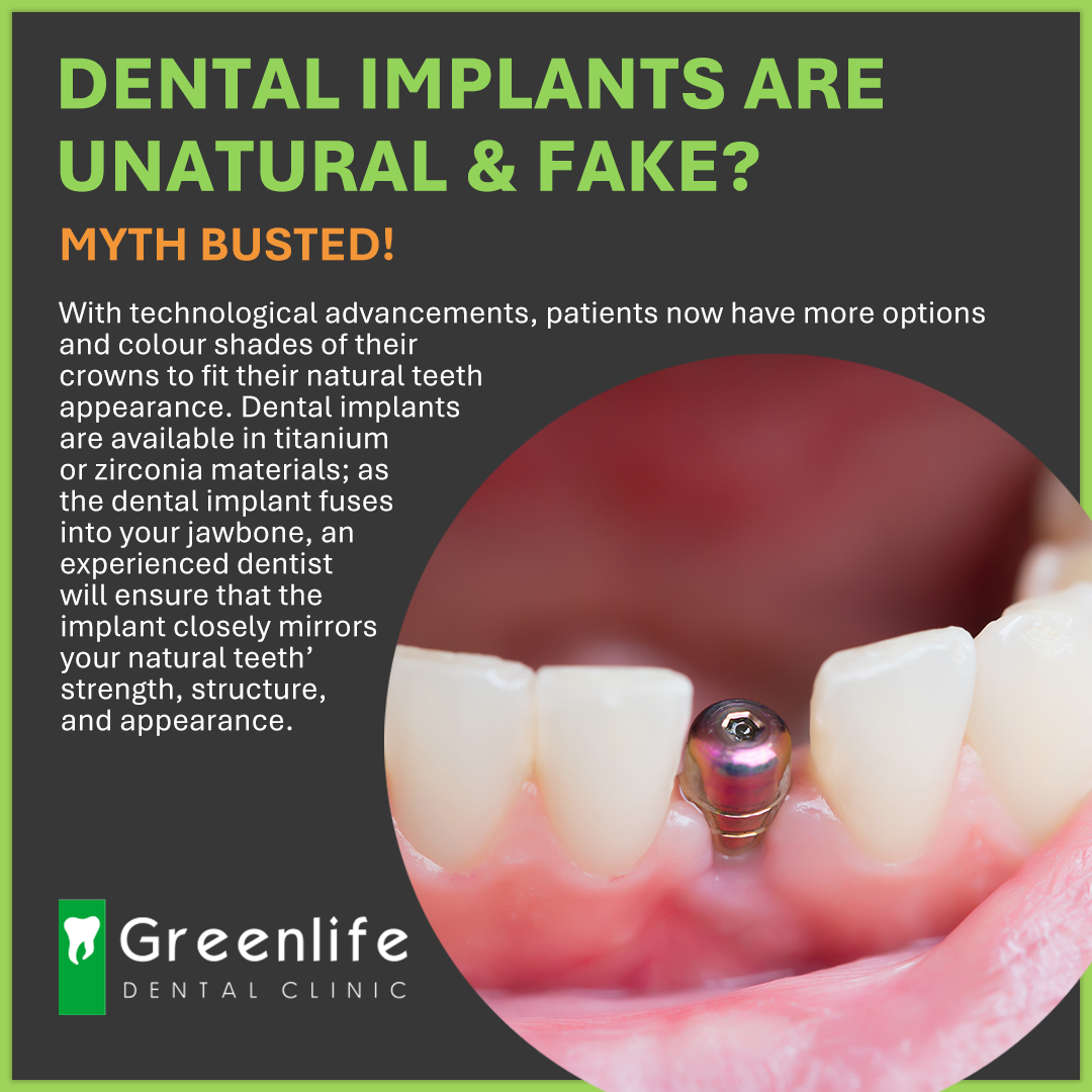 Debunking Common Myths About Dental Implants