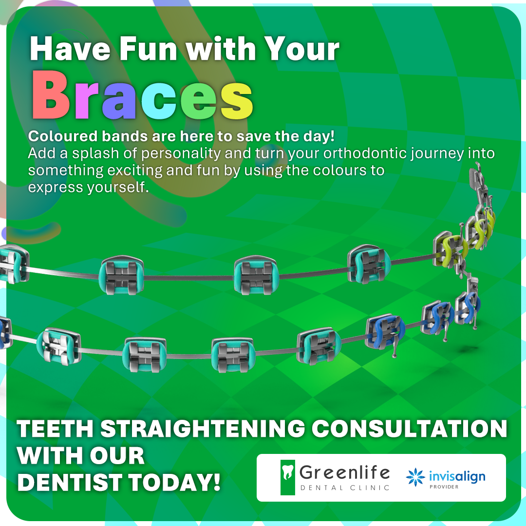 Have Fun With Your Braces